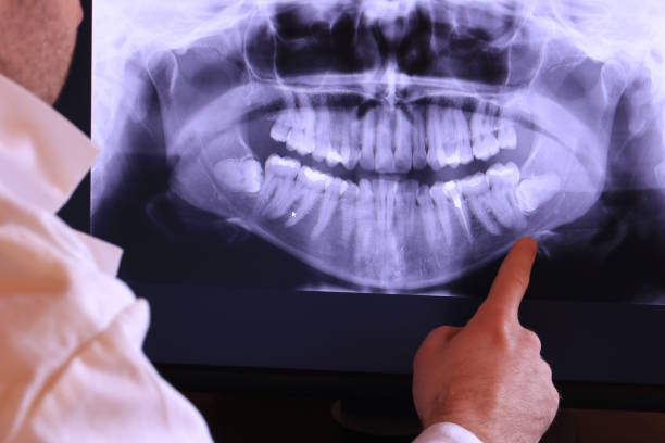Best Emergency Treatment for Toothache in Spring City, UT