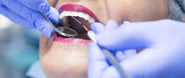 Best Emergency Tooth Extraction in Spring City, UT
