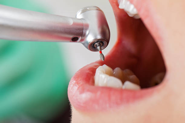 Best After-Hours Emergency Dentist in Spring City, UT